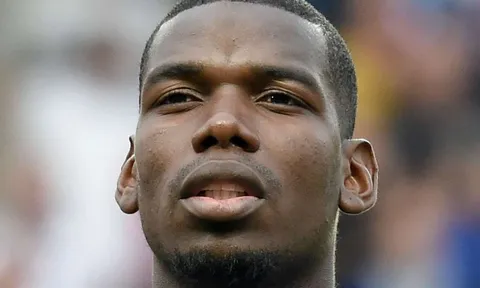 Pogba đang rất mơ hồ về chấn thương