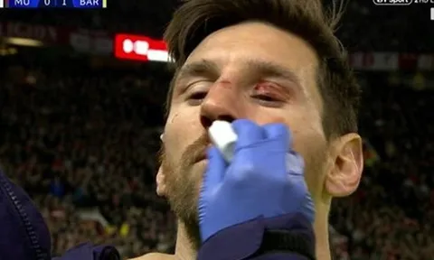 Smalling khiến Messi đổ máu ở Old Trafford