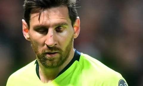 NÓNG: Smalling tiết lộ lời Messi nói sau pha va chạm kinh hoàng