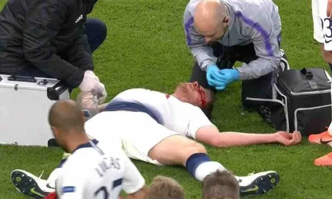 Tình trạng Vertonghen ra sao sau chấn thương kinh hoàng trước Ajax?