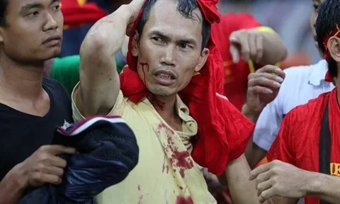 AFF Cup và top 6 'trò bẩn' khiến Đông Nam Á muối mặt