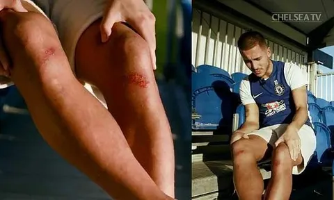 Chỉ đôi chân đỏ tấy, Hazard hứa bỏ thói quen ăn mừng