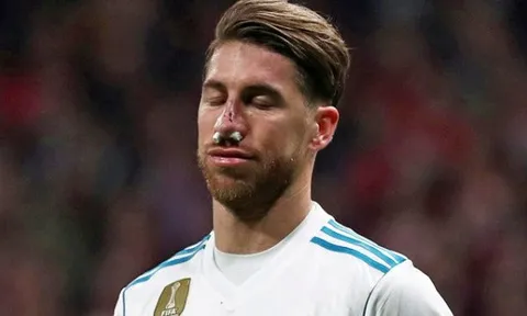 Cập nhật tình hình chấn thương mũi của Sergio Ramos