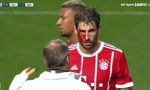 Javi Martinez đổ máu giúp Bayern giật 3 điểm rời Scotland