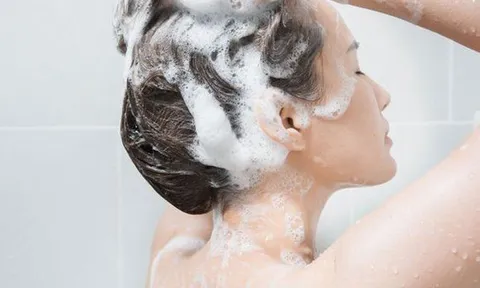 Gội đầu thường xuyên vẫn bong tróc da đầu: 5 công thức tự nhiên giúp giảm gàu rõ rệt