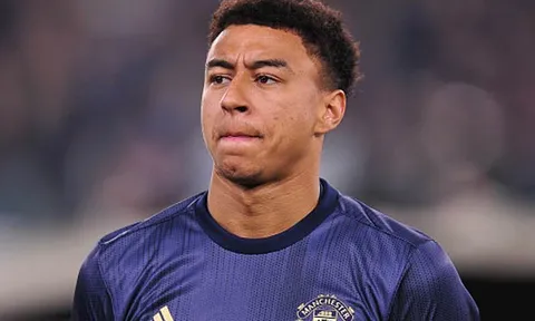 Lingard giải thích lý do M.U không ăn mừng chiến thắng Juventus