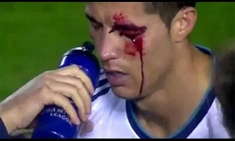Không phải lúc nào niềm vui cũng hiện diện ở Cristiano Ronaldo