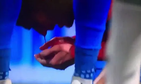 "Ngựa quen đường cũ", Ramos đánh vỡ mũi cầu thủ Plzen