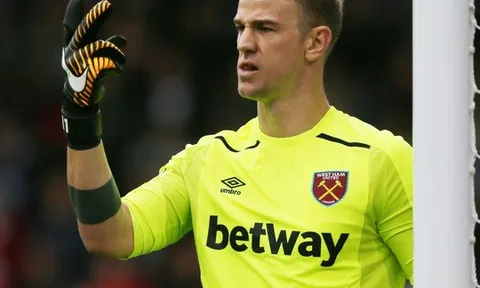 Thủ môn Joe Hart bị cướp
