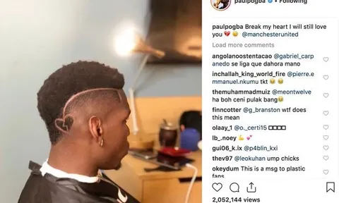 "Tôi vẫn yêu dù Man Utd làm tan nát trái tim tôi"