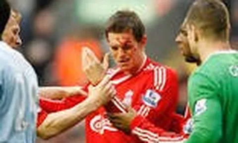 Vì sao Liverpool đang rất nhớ những mẫu trung vệ như Daniel Agger