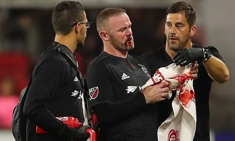 Rooney ghi bàn đẳng cấp rồi đổ máu trong chiến thắng của DC United