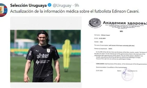 Bình phục chấn thương, Cavani sẵn sàng ra sân ở trận đấu với Pháp?
