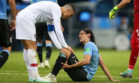 Cavani đi khập khiễng, dễ nghỉ đá trận gặp Pháp