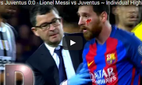 Màn trình diễn của Messi trước Juventus