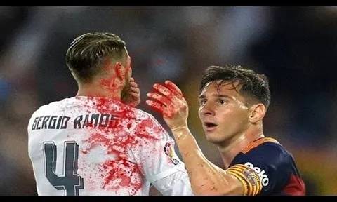 Những tình huống xấu xí ở El Clasico