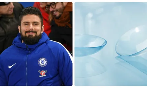 Olivier Giroud - Chiếc kính áp tròng và con ngươi chảy máu