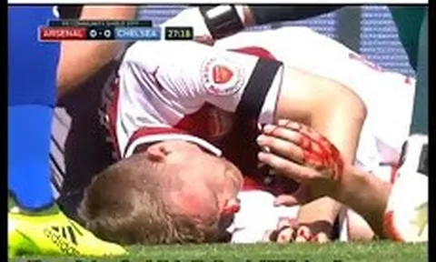 Tình huống khiến Mertesacker đổ máu