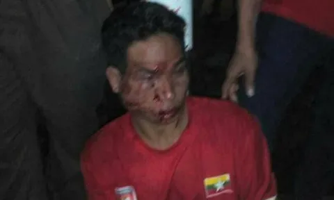Tới Shah Alam coi đá bóng, CĐV U22 Myanmar bị đánh cho sấp mặt