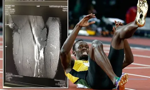 Usain Bolt lỡ cơ hội khoác áo Quỷ đỏ