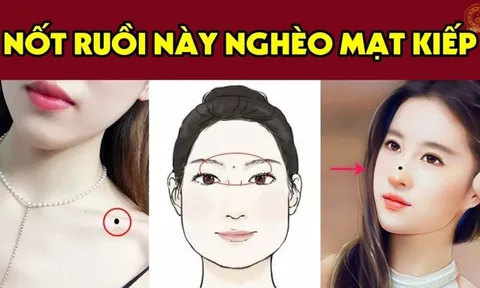 3 nốt ruồi lận đận nên tìm cách hóa giải kẻo về già cô độc