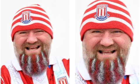 CĐV Stoke độ râu khủng để chào đón Chelsea