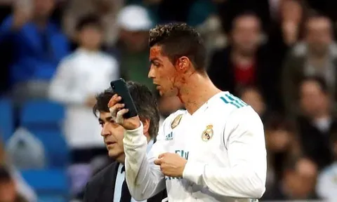 Cực hài: Ronaldo mượn điện thoại bác sĩ soi vết thương