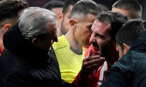 Đối phương giật cùi chỏ, sao Atletico Madrid gãy 3 răng cửa