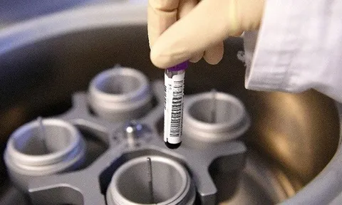 Nga bị loại khỏi World Cup 2018 vì doping?
