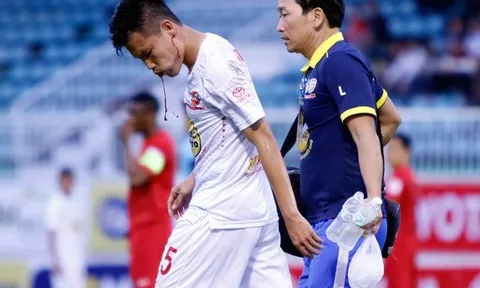 Những điểm nhấn vòng 2 V-League: Máu, nước mắt và dấu ấn trọng tài