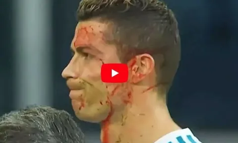Những lần bị phạm lỗi thô bạo của Cristiano Ronaldo