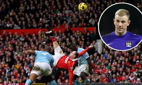 Những lần Joe Hart làm nền cho siêu phẩm