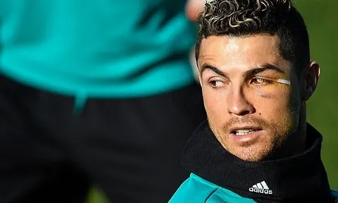 Ronaldo tập sung dù mắt sưng húp, quyết cứu nguy Real Madrid