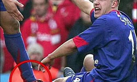 Tai nạn chấn thương kinh hoàng của Alan Smith vs Liverpool