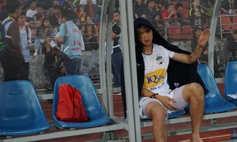 Điểm tin bóng đá Việt Nam sáng 18/3: Hồi hộp chờ chấn thương Tuấn Anh