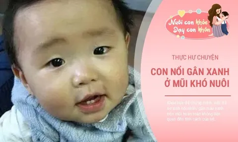 Thực hư chuyện trẻ nổi gân xanh ở mũi sẽ khó nuôi, khoa học giải thích