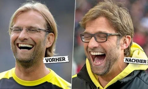 10 bí mật chưa được bật mí về Klopp