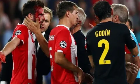 Atletico Madrid thắng nhẹ trên đất Hà Lan