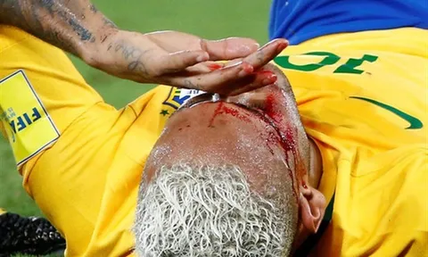 Chùm ảnh: Neymar chảy máu lênh láng trong chiến thắng '5 sao' của Brazil