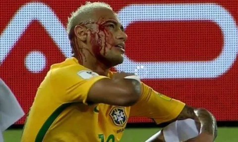 'Gạt tay' làm Neymar đổ máu, Duk còn muốn được tôn trọng
