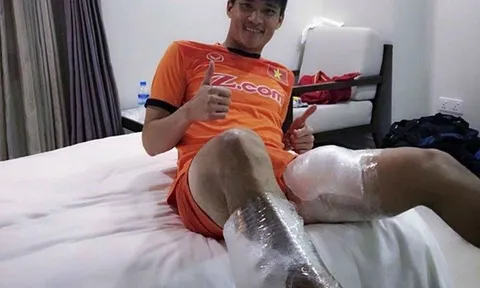 Hậu chiến thắng Malaysia, Công Vinh “khoe” hai đùi... chườm đá