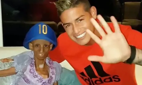 James Rodriguez hoàn thành giấc mơ của cô bé tuổi teen mắc bệnh hiểm nghèo