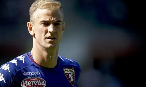 'Joe Hart làm chúng tôi ngạc nhiên'
