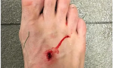 Suarez đáp trả Filipe Luis sau màn công kích trên MXH