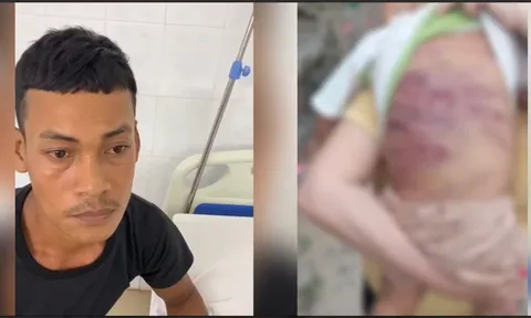 Hé lộ lời khai của cha dượng trong vụ bé trai 2 tuổi bị bạo hành đến nguy kịch