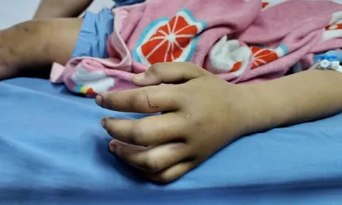 Hà Nội: Bé gái 4 tuổi tử vong sau khi bị cha dượng và mẹ ruột bạo hành trong phòng trọ