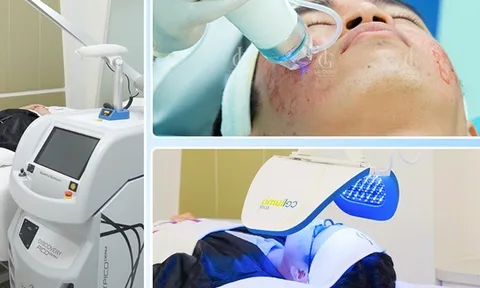 Giải mã 5 nguyên nhân giúp Triple Treatment trở thành công nghệ điều trị sẹo rỗ hàng đầu Việt Nam