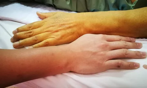 5 dấu hiệu cảnh báo gan thận đang "kêu cứu", số 1 bệnh đã chuyển nặng