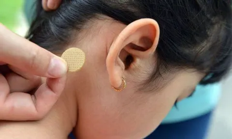Bé gái 7 tuổi bị rối loạn hành vi, nói nhảm suốt đêm vì tác dụng phụ của miếng dán chống say tàu xe