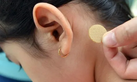 Từ vụ bé gái 7 tuổi thức trắng đêm, nói nhảm sau khi dán miếng chống say xe: Bố mẹ cần lưu ý gì khi sử dụng?